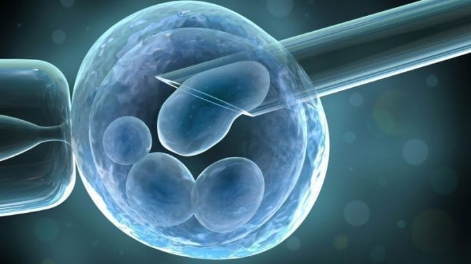 IVF (In-vitro-Fertilisation)