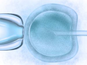 Secondary Fertility Complications 1