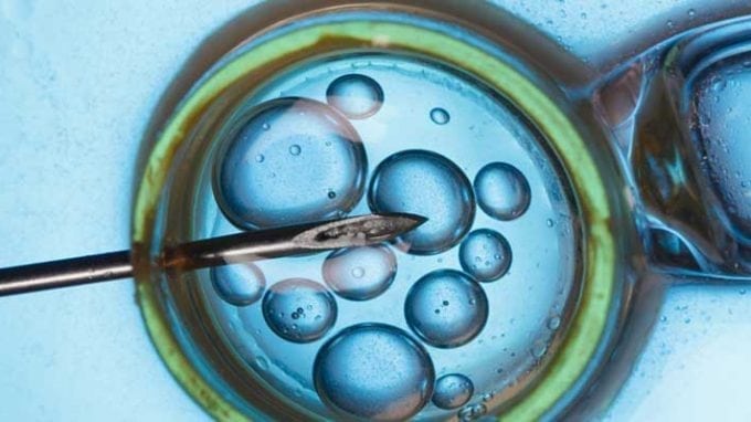 A New Complement to IVF Could Increase the Success in Older Women