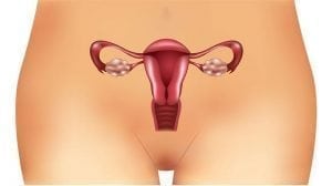 Ovarian Cysts and Their Impact on Fertility 1