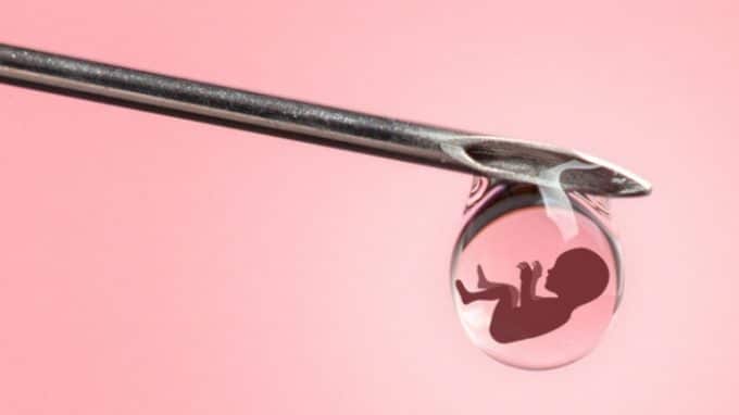 Everything You Want to Know About Donor Insemination