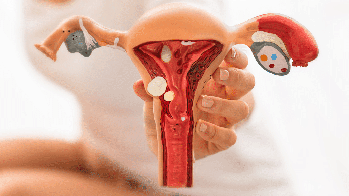 Everything You Need to Know About Primary Ovarian Insufficiency
