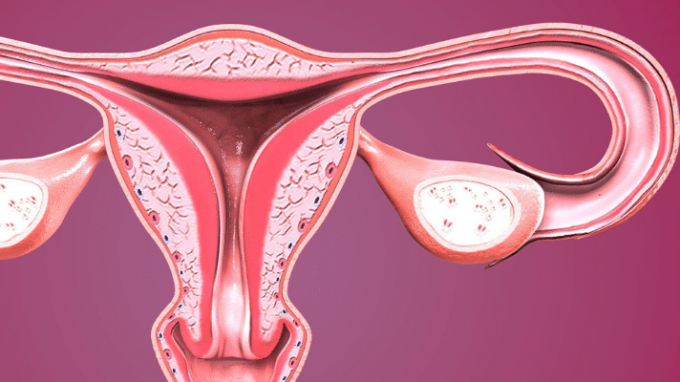 Fallopian Tube Abnormalities That Can Affect Fertility
