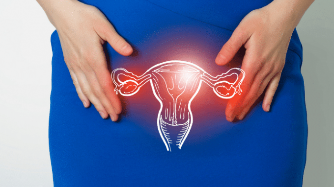 Everything You Need to Know About Pelvic Adhesions and Your Fertility